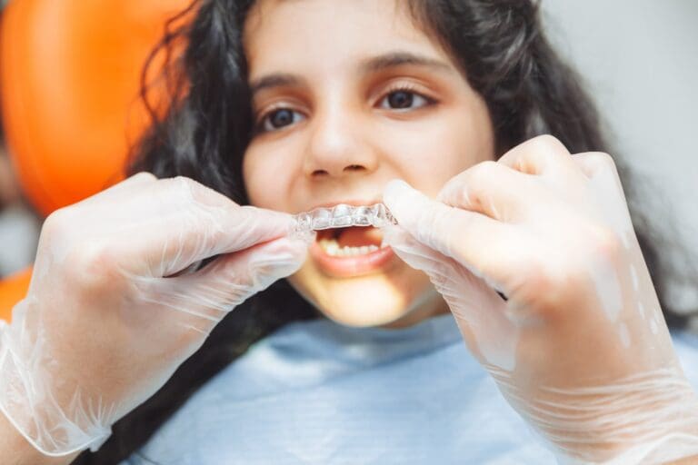 A person with curly hair is having a clear dental aligner fitted by hands wearing gloves.