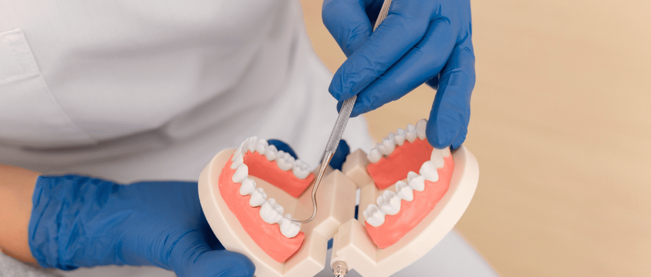 A person wearing blue gloves demonstrates dental techniques on a set of artificial teeth using a dental tool.