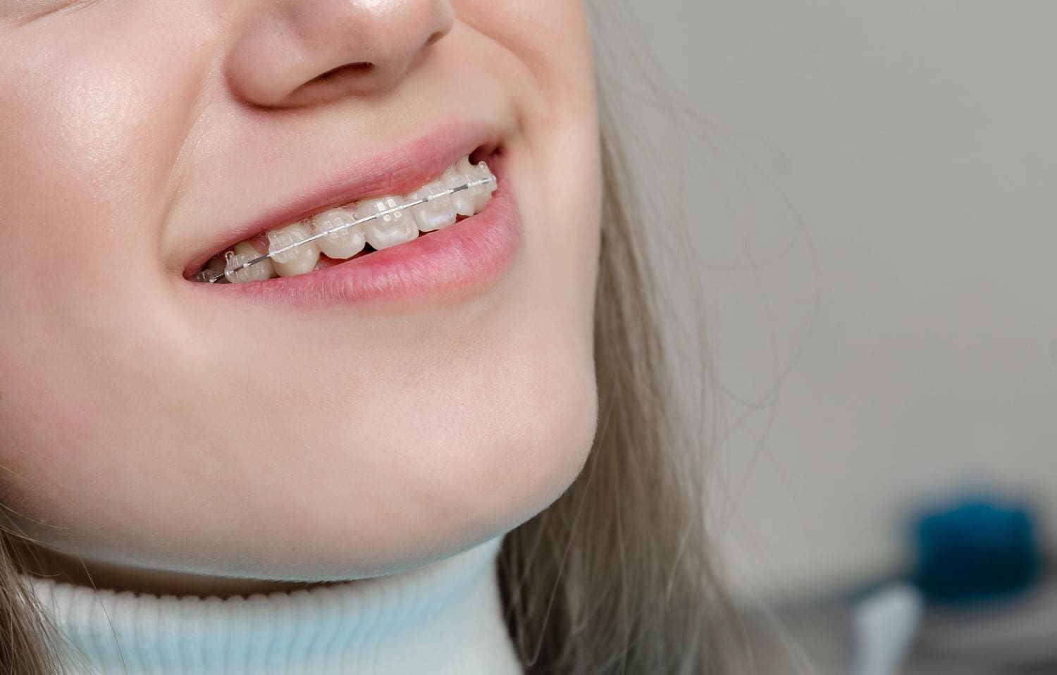 Close-up of a person smiling with clear braces on their teeth, showcasing the best orthodontics can offer.