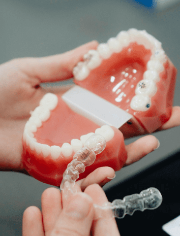 Close-up of hands holding a dental model with an aligner being placed on the top teeth.
