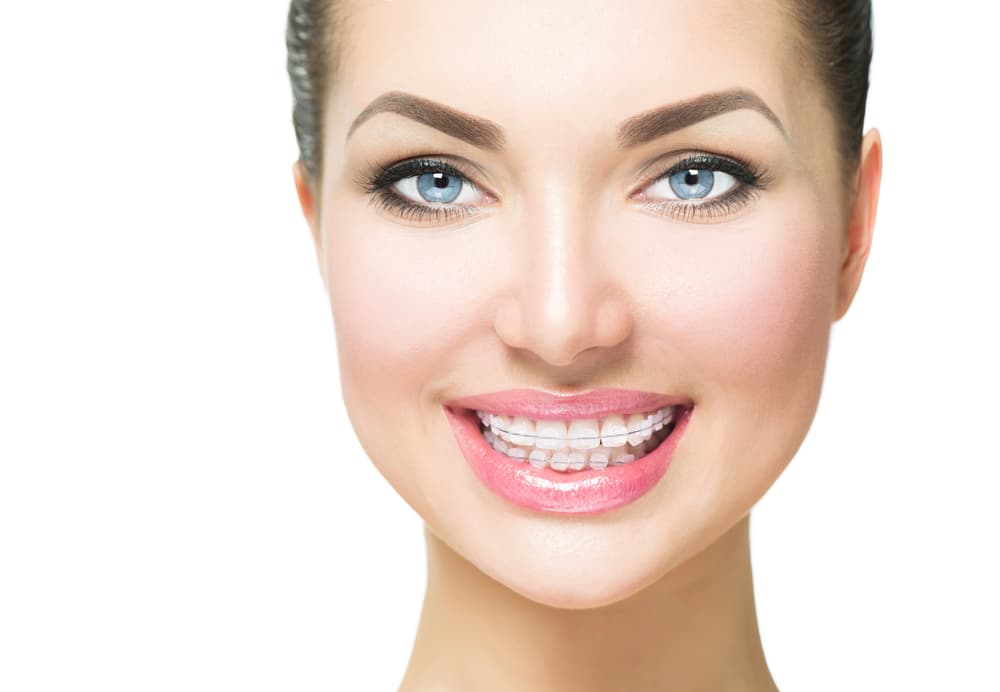 Happy adult showing progress with clear braces during a check-in at the orthodontic clinic